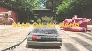 scar on my hand - rusty clanton