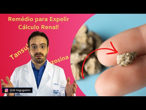 Essa Medicação Ajuda a Expelir Cálculo Renal!