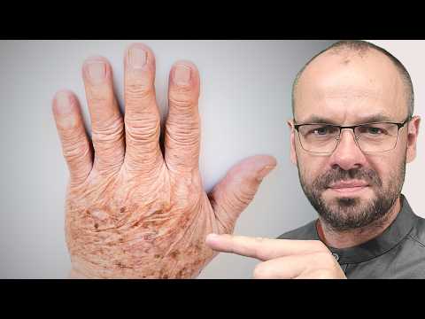 Ciemne plamy znikają w 8 tygodni! Sprawdź ten prosty sposób.