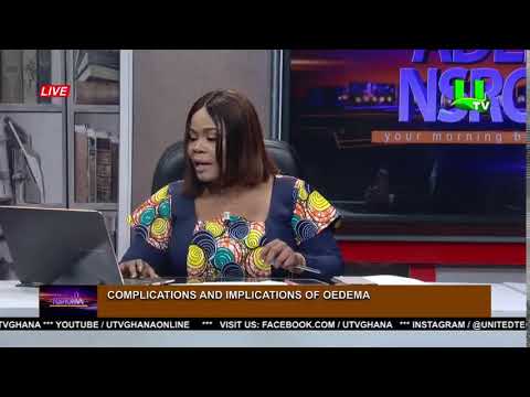 COMPLICATIONS AND IMPLICATIONS OF OEDEMA 21/03/22