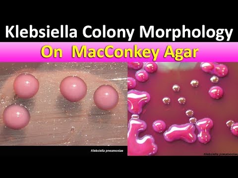 Download Colonial Morphology Of E Coli 3gp Mp4 Codedwap