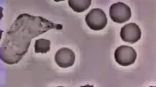 Akyuvar Hücresi Mikrobu Nasıl Yok Eder?