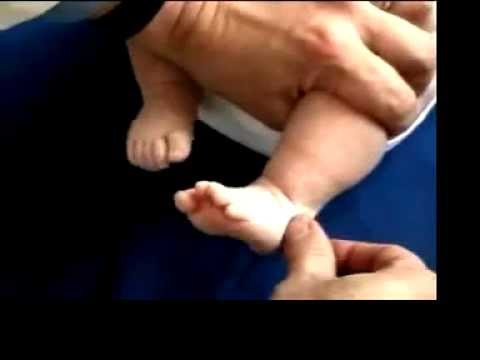 Verursacht Cervical-thorakale Osteochondrose Registrieren Endoprothetik
