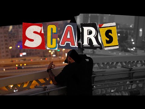 Romano Santino - Scars (prod. by Bien)