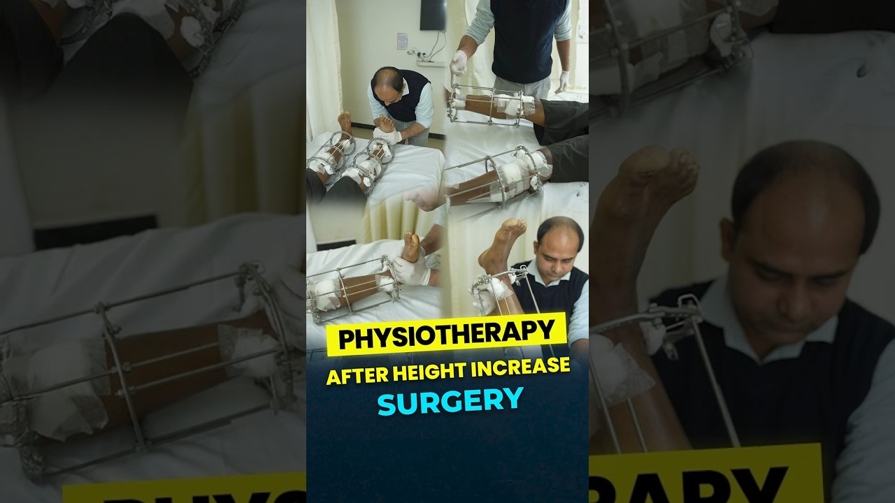 Physiotherapy After Limb Lengthening Surgery | Height Increase Recovery at Heights Plus