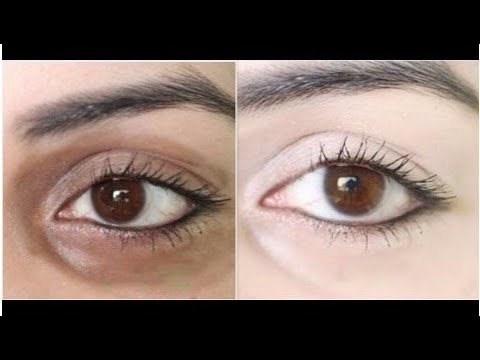 How To Remove Dark Circles Under Eyes