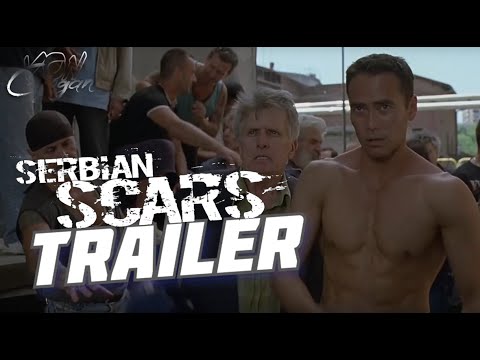 Video $Serbian Scars
