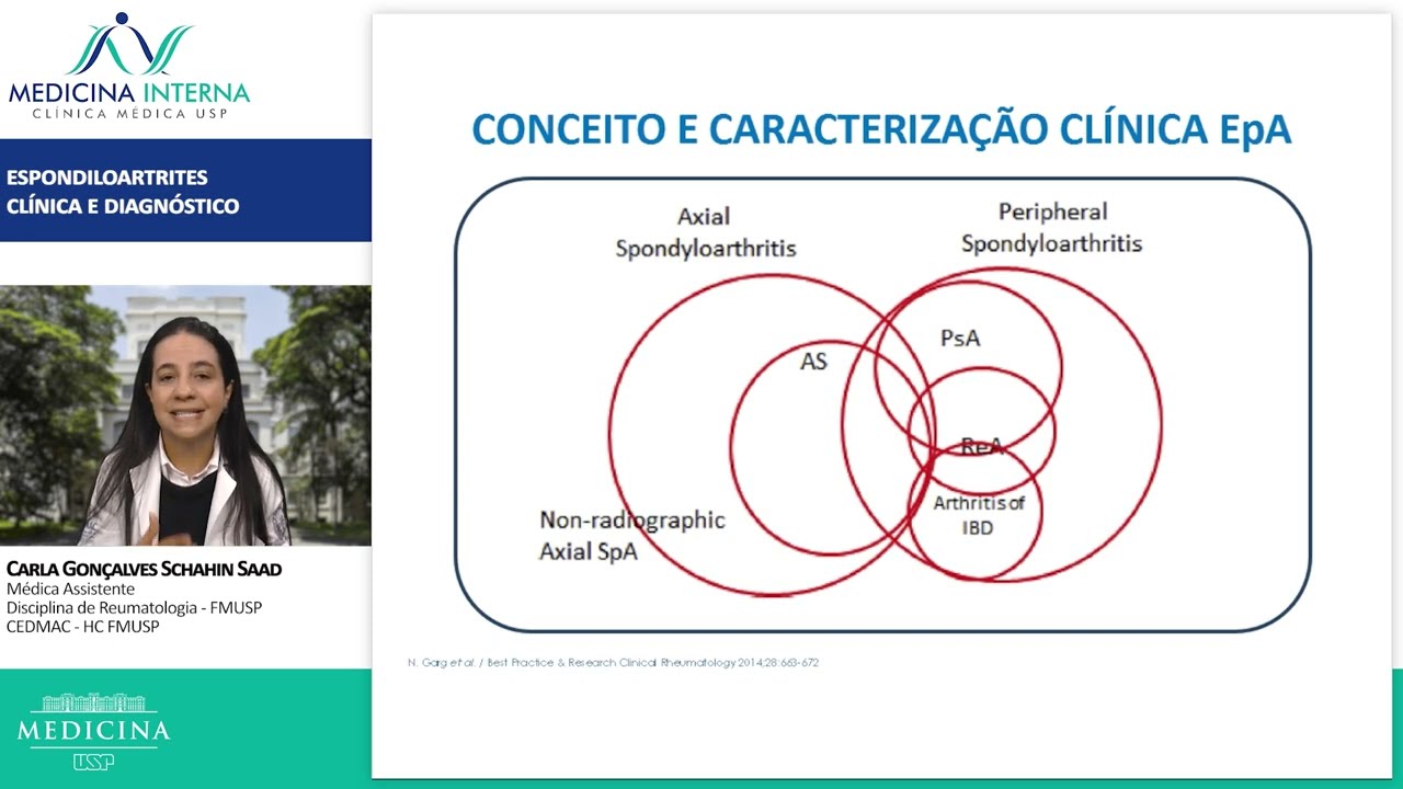 Espondiloartrites: Clínica e Diagnóstico