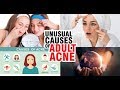 How to Get Rid of Pimple Scars on Body