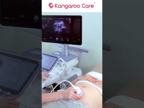 Why is pregnancy scanning so important? Insights from Dr. Preeti Allum