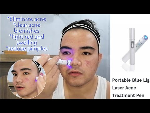 #Day1 KD-7910 Blue Light ACNE Lacer Treatment Review
