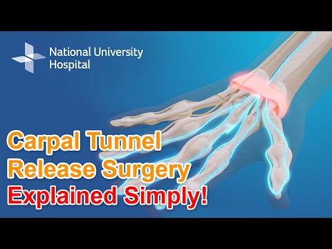 Carpal Tunnel Release Surgery - Explained