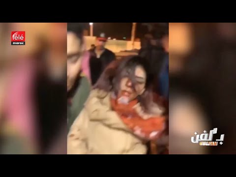 عملية جراحية للرابر بسيكو كوين بعد تعرضها لإعتداء خطير