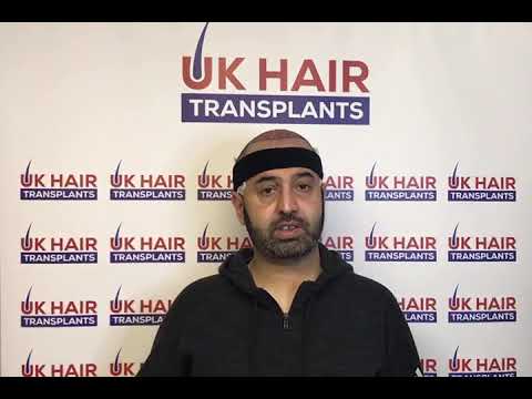 Patient feedback and review after a FUE Hair Transplant / Hair restoration surgery in Birmingham