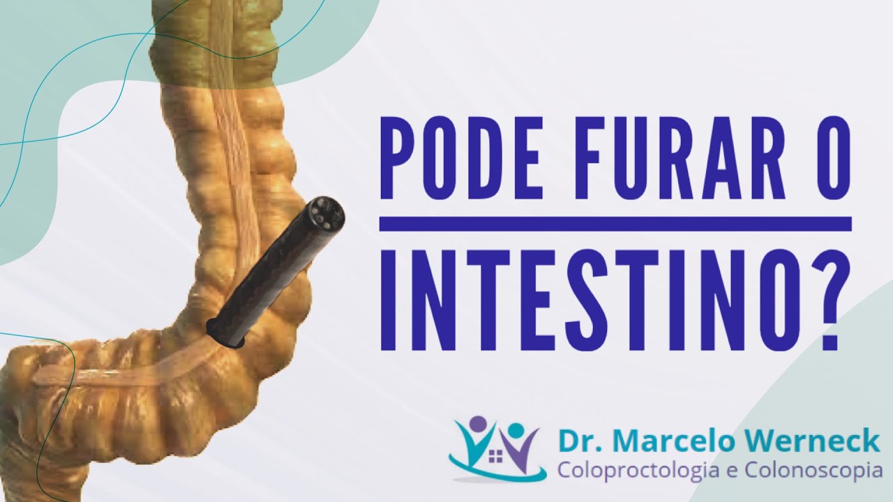Colonoscopia pode furar o intestino?