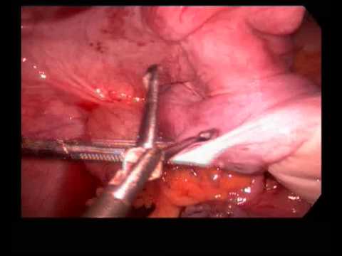 Rajani Hospital Video 9