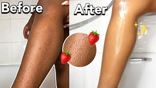 HOW TO GET RID OF STRAWBERRY LEGS ‼️Get rid of dark spots and get SMOOTH legs‼️