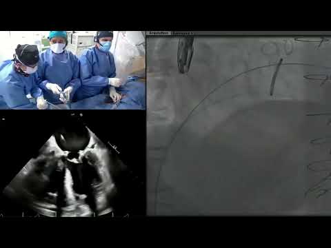 Live Case #2   2025