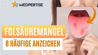 Folatmangel / Folsäuremangel - 8 Anzeichen, die dafür sprechen, dass du einen Mangel an Folat hast!