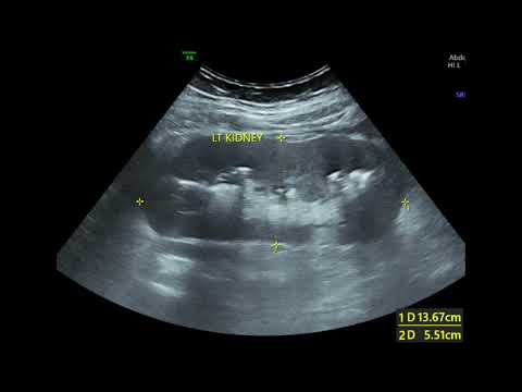 Ultrasound Spotters / Quiz - 7