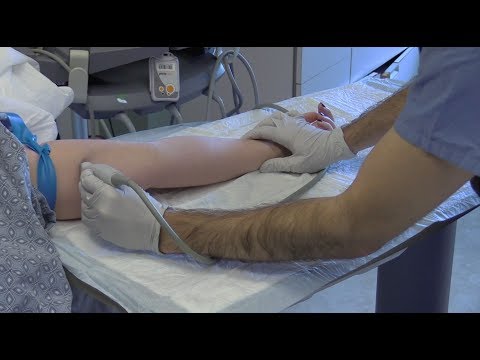Ultrasound-Guided Peripheral IV Insertion -- BAVLS