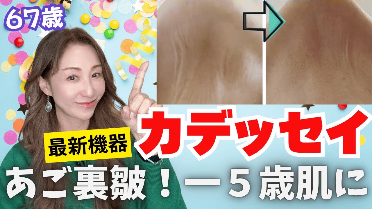 【美容医療】✨『カデッセイ』シワに最強⁉️最新機器の効果はどう？【高周波】【照射施術】