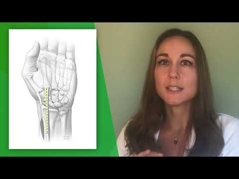 Top 3 Things Patients Wish they Knew Before Thumb Arthritis Surgery by Debra Anne Bourne, MD