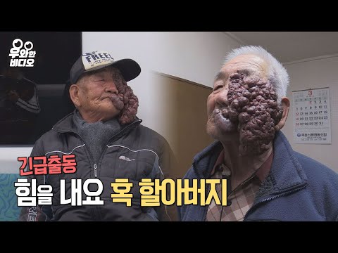 , title : '혹 할아버지의 얼굴 성형 렛미인 (1부)┃A grandfather with a huge face cyst gets a plastic surgery (episode 1)'