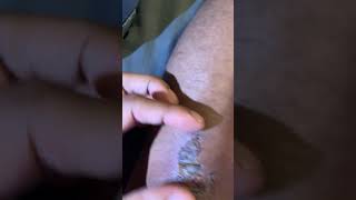 Halarious Scab removal