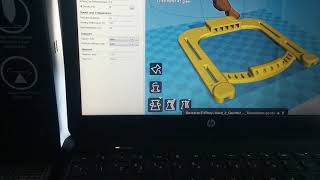 Prosthesis 3D, the cheapest efficient revolution?