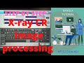 X Ray CR Print Processing Ep 12 Fujifilm Image Processing System Bangla Tutorial