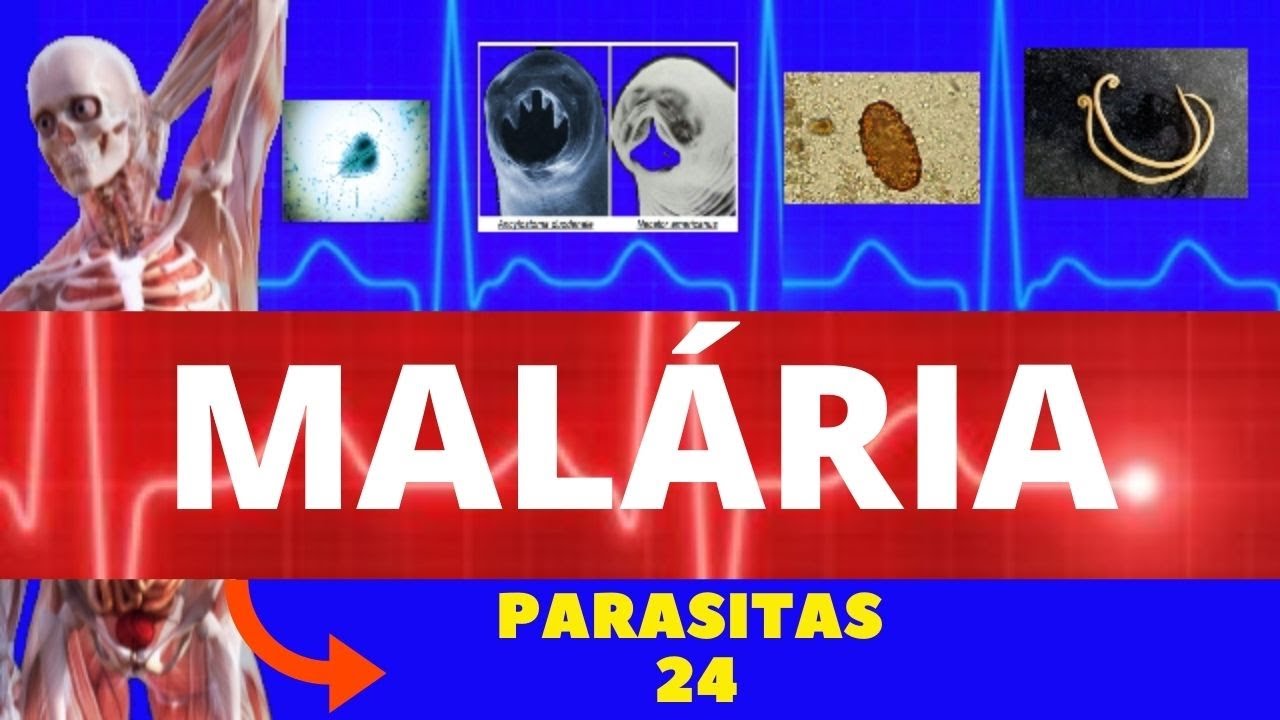 MALÁRIA - PLASMODIUM SP - PARASITOLOGIA | INFECTOLOGIA (PARA SUA PROVA PRÁTICA E TEÓRICA)