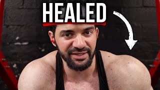 How I FIXED My Shoulder Injury - While Still Making Gains (Full Checklist)