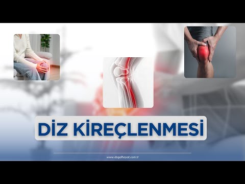 Diz sıvı kaybı
