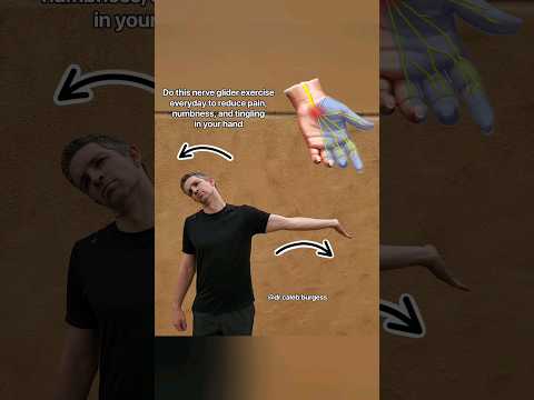 Do THIS to fix HAND numbness, tingling, and pain! - #nervepain #nervepainrelief #handpain