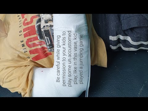 Closed Reduction | Greenstick Fracture both bones forearm | Short GA | Adamya hospital videos