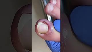 Easily trim long toenails~ #nails #pedicure