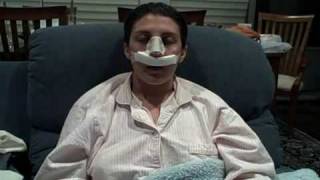 My New Nose…Again! VJournal: Post-Op Day 1 (pt. 2)