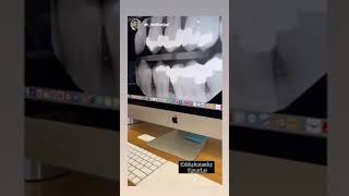 Pearl's dental AI validate Dr. Matt Nejad's x-ray evaluation