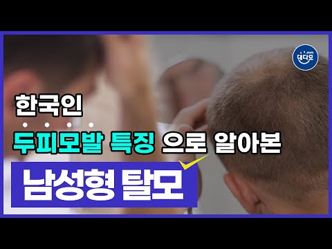 한국인의 두피모발 특징으로 알아본 남성형 탈모 | 젊은 나이 남성형 탈모 징후에 대한 다양한 의견 | 남성형 탈모증에 대한 연구 사례