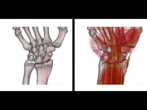 Mal di gola e mal di schiena Mal di schiena nella parte bassa della schiena durante la gravidanza