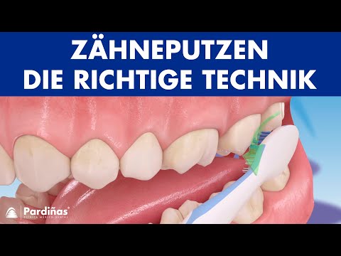 Zähneputzen – Die richtige Technik ©