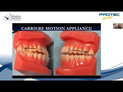 WEBINAR: Carriere Motion Appliance