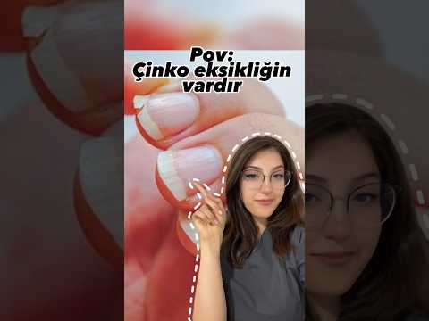 Çinko nedir? Çinko'nun görevleri nelerdir?
