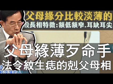 男人法令有痣