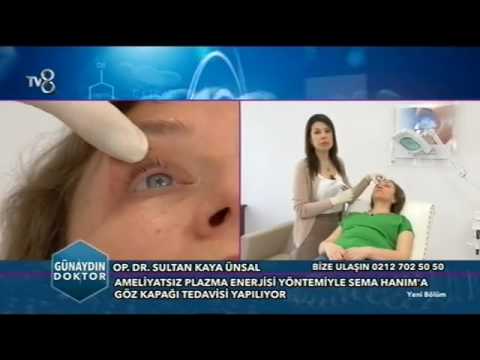 Op. Dr. Sultan Kaya Ünsal – TV8 Günaydın Doktor – Ameliyatsız Göz Kapağı Tedavisi