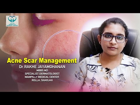 EverythingSkin | Acne Scar Management | Dr.RAKHE J |  MD SPECIALIST DERMATOLOGIST | MAMPILLY MEDICAL