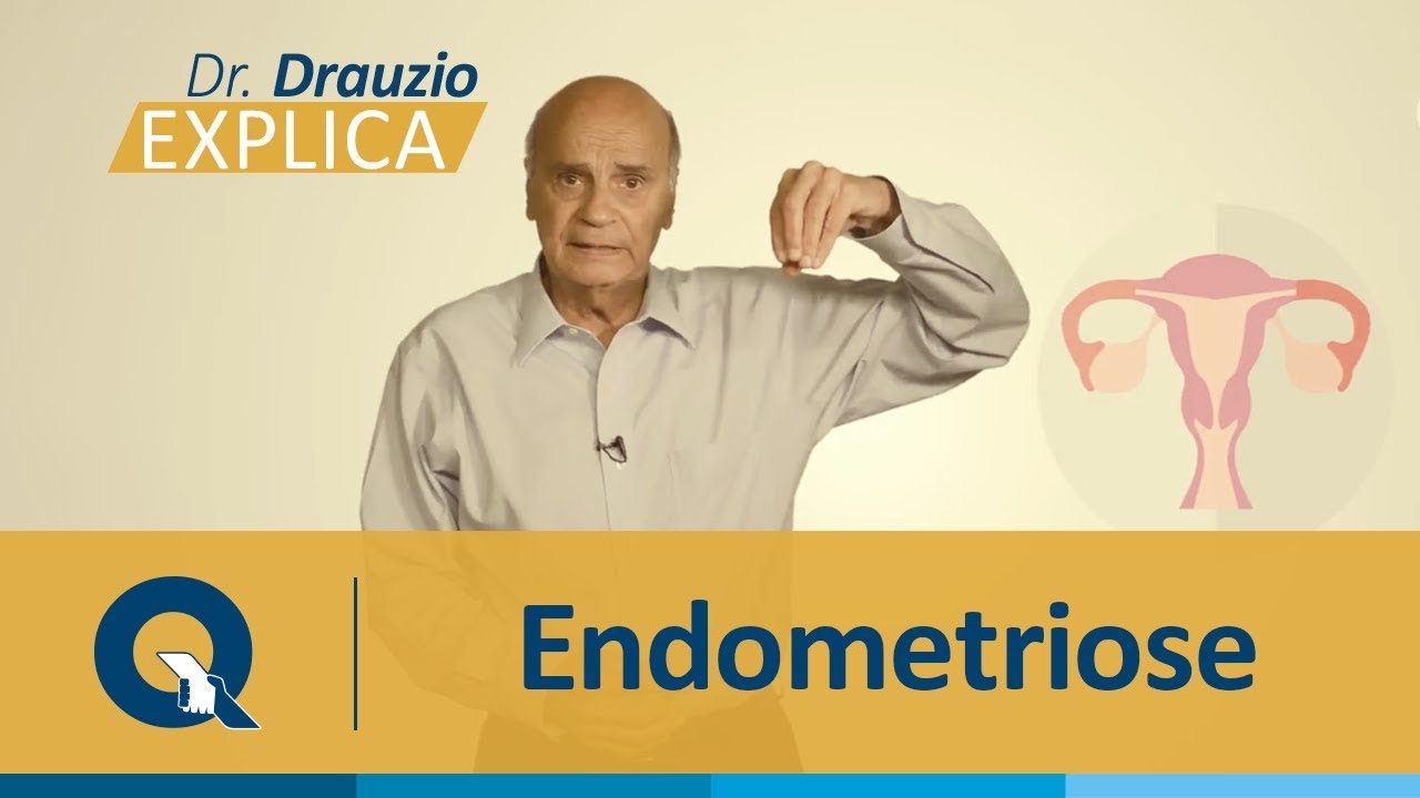 Dr. Drauzio Varella explica o que é Endometriose.