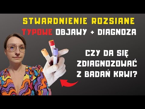 Jak wykluczyć albo potwierdzić stwardnienie rozsiane? Pierwsze objawy typowe dla SM.  | O, choroba!