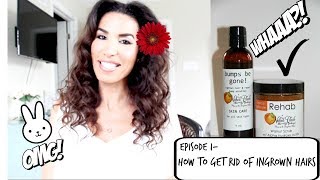 Episode 1, How to get rid of ingrown hairs!
